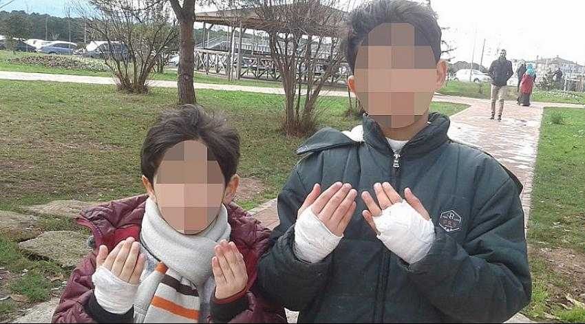 İki çocuğunun elini sobada yakan Suriyeli baba tutuklandı