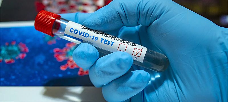 Son 24 saatte koronavirüsten 74 kişi hayatını kaybetti