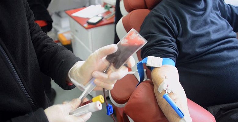 Türkiye koronavirüste yeni tedavi yöntemini deneyecek